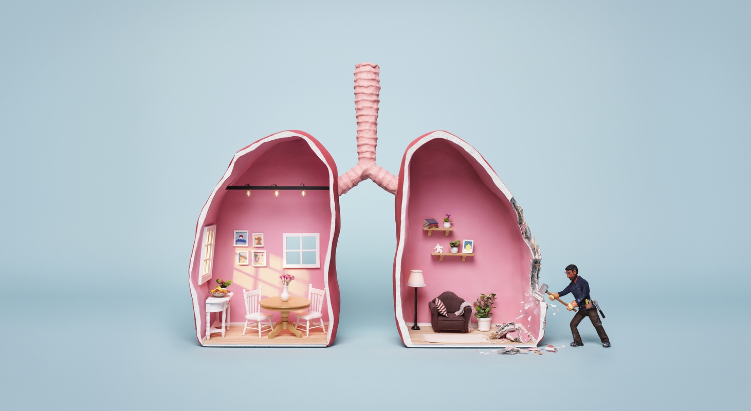 Asbestos thumbnail